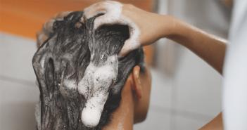 Zsíros haj kezelése - mit kell tenni zsíros hajjal, mit kell mosni és hogyan kell ápolni